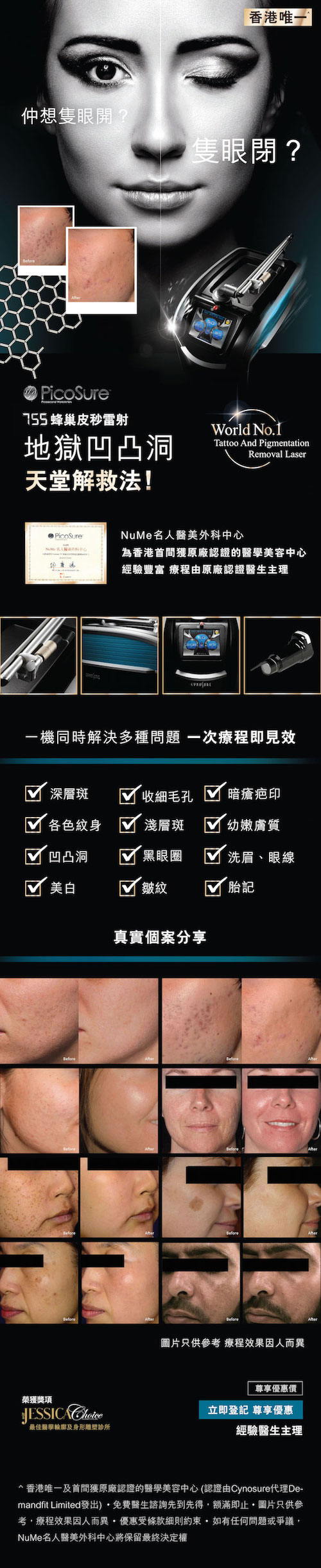 20161124_ PicoSure _皮秒雷射_去凹凸洞_mobile.jpg